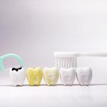 Pigmentacija na zubima