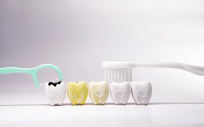 Pigmentacija na zubima